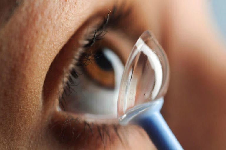 Lentes de contacto para queratocono
